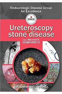 copertina di Ureteroscopy for stone disease