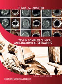 copertina di TAVI ( Transcatheter aortic valve implantation ) in complex clinical and anatomical ...