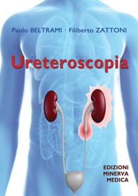 copertina di Ureteroscopia
