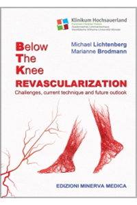 copertina di Below the knee revascularization - Challenges, current technique and future outlook