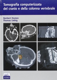 copertina di Tomografia computerizzata ( TC ) del cranio e della colonna vertebrale