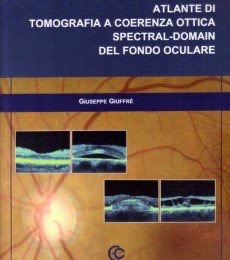 copertina di Atlante di Tomografia a coerenza ottica: Spectral - Domain del Fondo Oculare