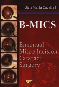 copertina di B - MICS - Bimanual Micro Incision Cataract Surgery