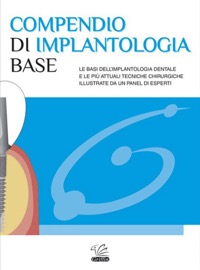 copertina di Compendio di implantologia base