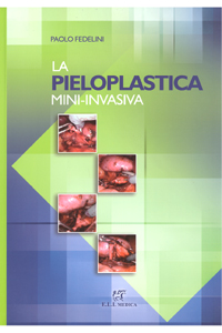 copertina di La pieloplastica mini - invasiva