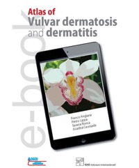 copertina di Atlas of vulvar dermatosis and dermatitis