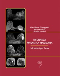 copertina di Risonanza magnetica ( RM ) mammaria - Istruzioni per l' uso