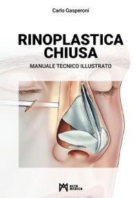 copertina di Rinoplastica chiusa - Manuale tecnico illustrato