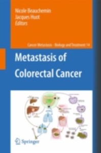 copertina di Metastasis of Colorectal Cancer