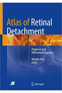 copertina di Atlas of Retinal Detachment - Diagnosis and Differential Diagnosis