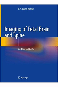 copertina di Imaging of Fetal Brain and Spine - An Atlas and Guide