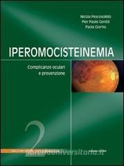 copertina di Iperomocisteinemia - Complicanze oculari e complicanze