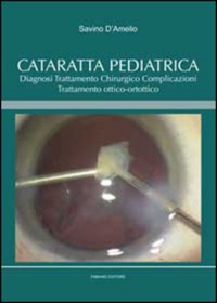 copertina di Cataratta pediatrica - Diagnosi, trattamento chirurgico, complicazioni, trattamento ...