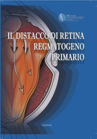 copertina di Il distacco di retina regmatogeno primario - Rapporto SOI 2008