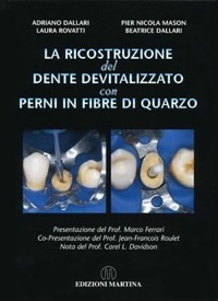 copertina di La ricostruzione del dente devitalizzato con perni in fibre di quarzo