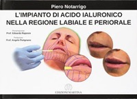 copertina di L' impianto di acido ialuronico nella regione labiale e periorale