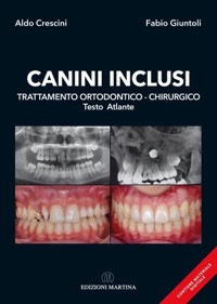 copertina di Canini inclusi - Trattamento Ortodontico - Chirurgico - Testo Atlante