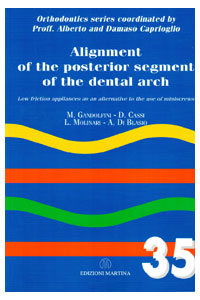 copertina di Alignment of the posterior segment of the dental arch - Low frictionappliances as ...