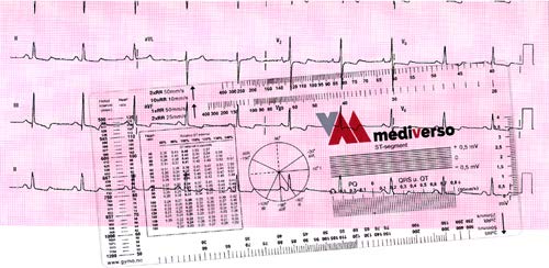 copertina di Righello medico di ECG - Con Istruzioni per l' uso