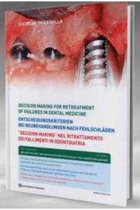 copertina di Decision Making nel ritrattamento dei fallimenti in odontoiatria - Volume 4 ( libro ...