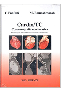 copertina di Cardio TC ( Tomografia computerizzata ) - Coronarografia non invasiva