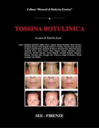 copertina di Tossina Botulinica