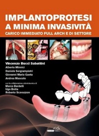 copertina di Implantoprotesi a minima invasivita' - Carico immediato full arch e di settore