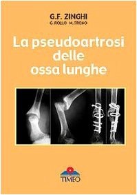 copertina di La pseudoartrosi delle ossa lunghe