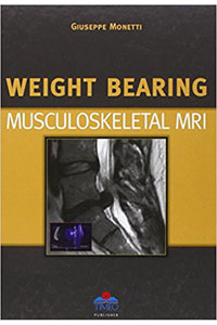 copertina di Weight bearing. Musculoskeletal MRI ( Magnetic resonance Imaging )