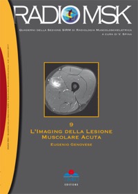 copertina di L' imaging della lesione muscolare acuta - Volume 9 - Collana RadioMSK