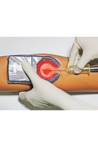 copertina di Veinspy - rilevatore vene portatile