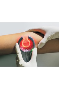 copertina di Veinspy - rilevatore vene portatile