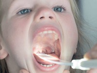 copertina di Abbassalingua luminoso - throat scope (1 MANICO E 2 LAME)