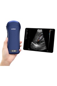 copertina di Ecografo portatile lineare convesso cardiaco 3 in 1 wireless