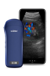 copertina di Ecografo portatile lineare convesso cardiaco 3 in 1 wireless