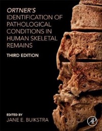 copertina di Ortner' s Identification of Pathological Conditions in Human Skeletal Remains