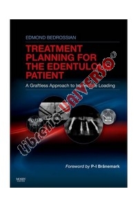 copertina di Implant Treatment Planning for the Edentulous Patient - A Graftless Approach to Immediate ...