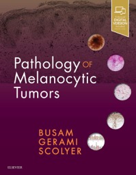 copertina di Pathology of Melanocytic Tumors