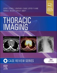 copertina di Thoracic Imaging - Case Review