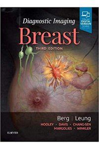 copertina di Diagnostic Imaging: Breast