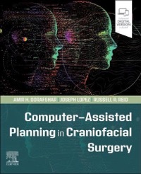copertina di Computer - Assisted Planning in Craniofacial Surgery