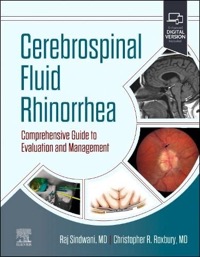 copertina di Cerebrospinal Fluid Rhinorrhea - Comprehensive Guide to Evaluation and Management ...
