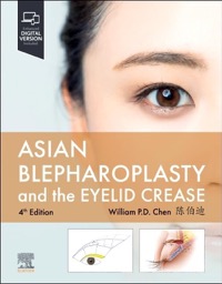 copertina di Asian Blepharoplasty and the Eyelid Crease