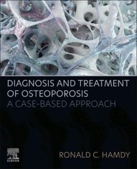 copertina di Diagnosis and Treatment of Osteoporosis: A Case - Based Approach 
