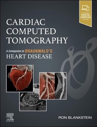 copertina di Cardiac Computed Tomography - A Companion to Braunwald' s Heart Disease 
