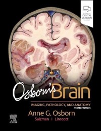 copertina di Osborn' s Brain - Imaging, Pathology, and Anatomy