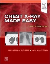 copertina di Chest X - Ray Made Easy