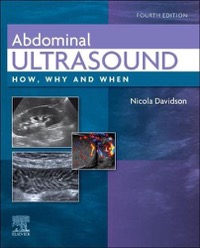 copertina di Abdominal Ultrasound . How , Why and When