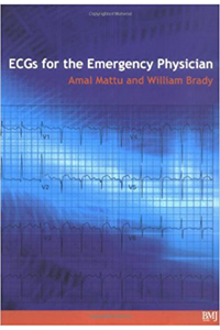 copertina di ECGs for the Emergency Physician - Level 1