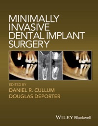 copertina di Minimally Invasive Dental Implant Surgery